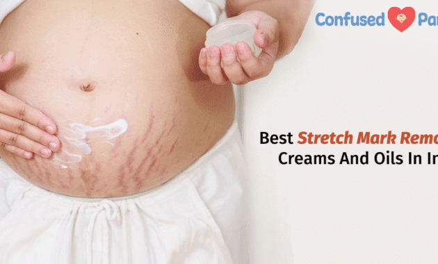 Best Stretch Marks Removal Creams Oils In India