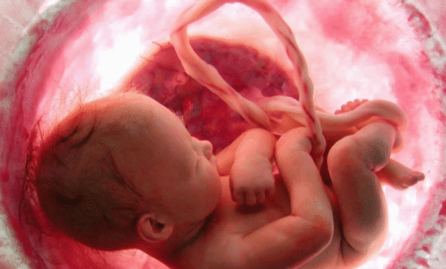 Female Feticide