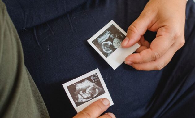 How To Increase Fetal Weight During Pregnancy For A Healthy Birth Weight Of Baby Boy Or Baby Girl 01