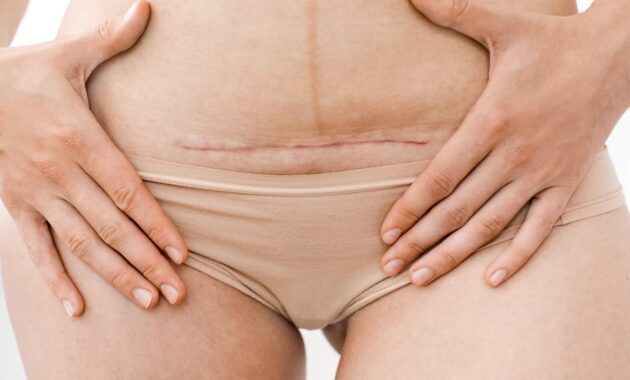 iStock 1020522864
