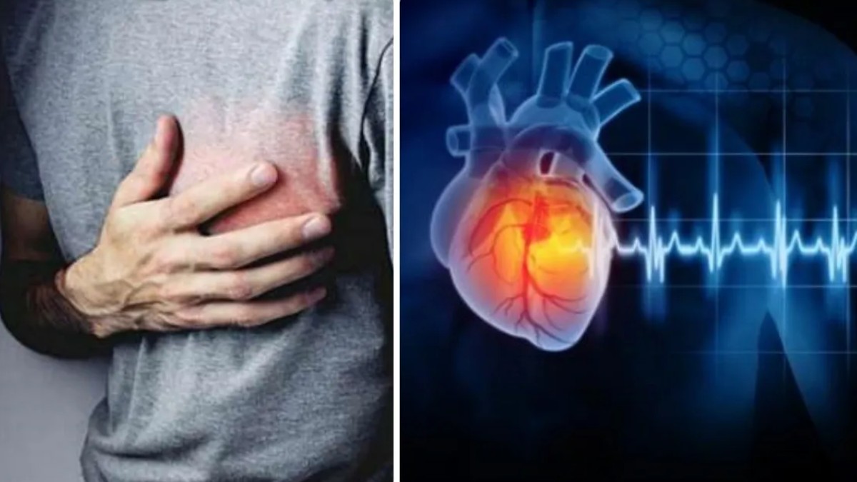 heart attack 2 1775127469.jpg